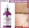 Anti-Acne Face Serum